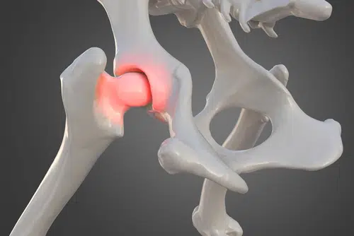 x ray image showing red area of hip dysplasia in dogs
