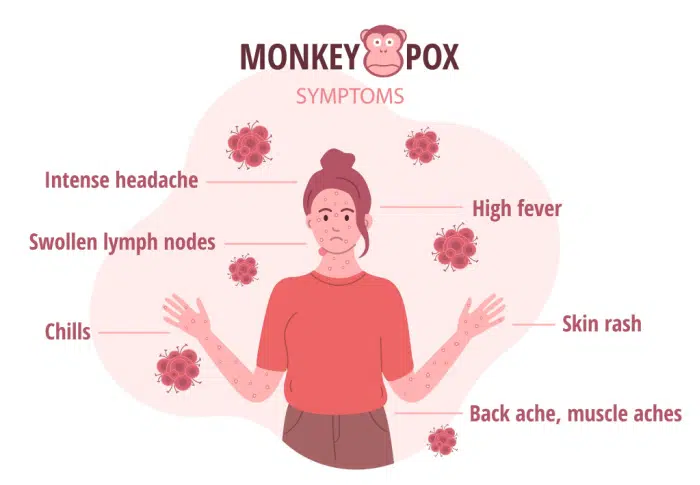 monkeypox in Australia: symptoms chart